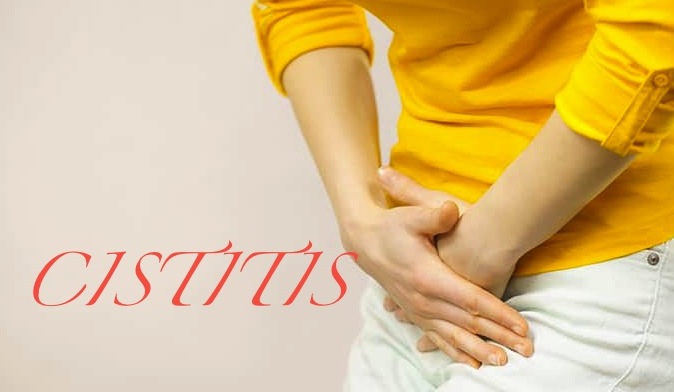 CISTITIS