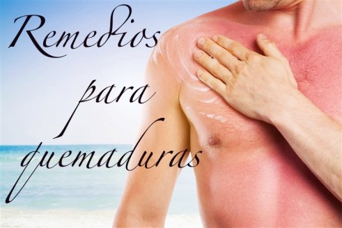 remedios quemaduras solares